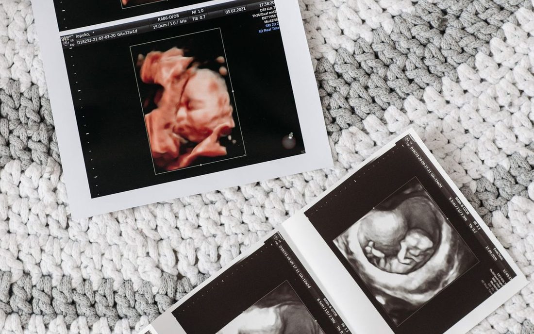 Imagens impressas de ultrassom de um bebê sobre uma manta clara