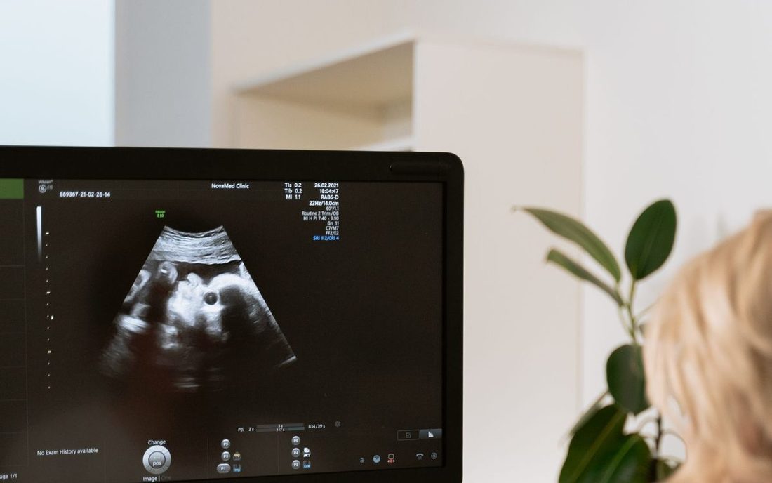 Monitor de aparelho de ultrassom exibindo uma imagem de exame, com a médica ao painel
